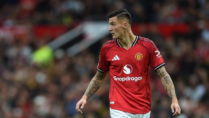 Laga MU VS Arsenal, Meski Kalah Tapi Banjir Pujian Dari Fans